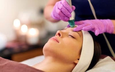 Microdermabrasie