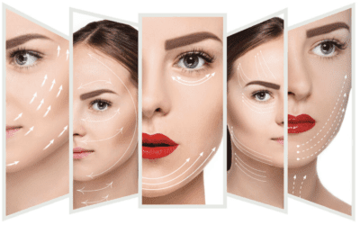 5-D HIFU non invasive huidverbetering