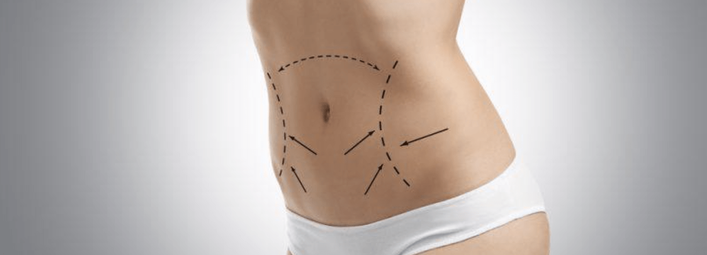 velashape