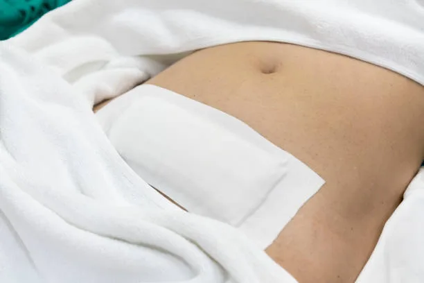 Post-Operatieve zorg na cosmetische chirurgie Post-Operatieve zorg na cosmetische chirurgie