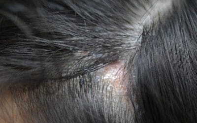 dr CYJ Hair Filler