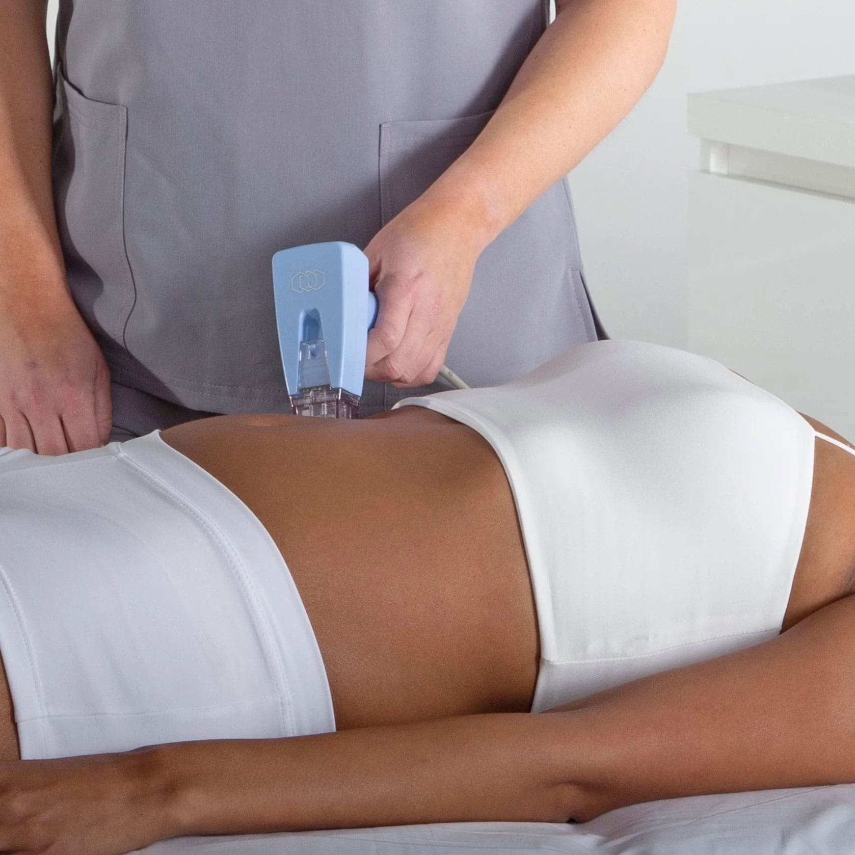 microneedling rf microneedling behandeling amsterdam